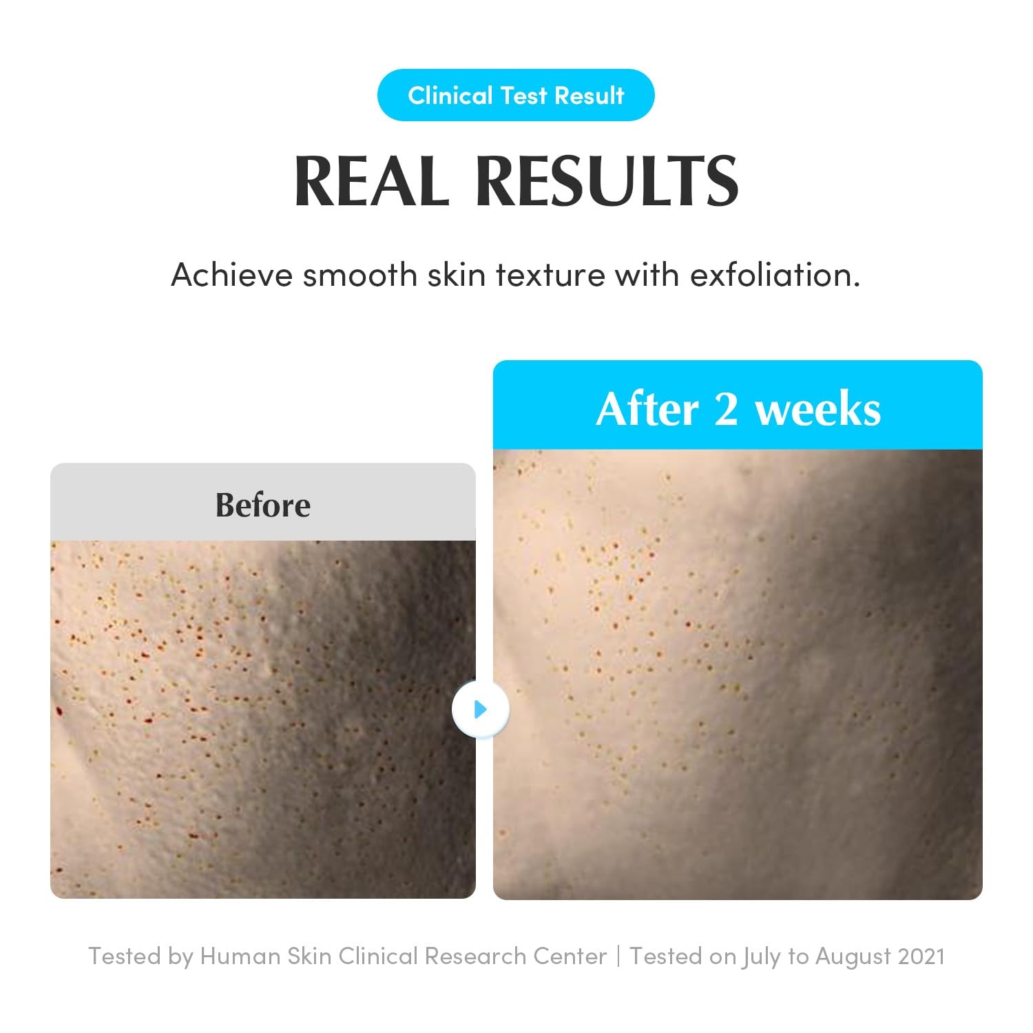 image:imageEQQUALBERRY Swimming Pool Toner Korean Toner for Daily Exfoliating amp Deep Hydration with Natural Enzyme Protease amp Hyaluronic Acid For Sensitive Skin 1014 Fl Oz 300ml1014 Fl Oz Pack of 1