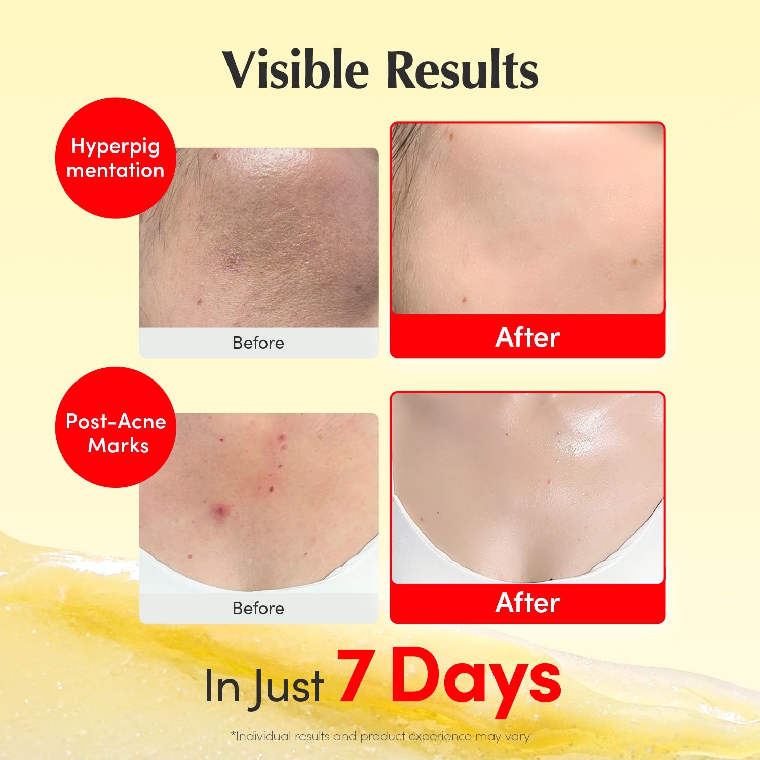 image:imageEQQUALBERRY Vitamin C Dark Spots amp Brightening Duo Vitamin Illuminating Serum amp Cream with Niacinamide TXA amp Ceramides Korean Skincare Set for Even Tone amp Glow