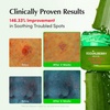 EQQUALBERRY ALOE PDRN Calming Cream | 7% Aloe PDRN & 10% Aloe Vera Water + 5-Cica | Cooling Gel Moisturizer for Oily Skin, Barrier Repair & Blemish Marks | Korean Skincare (1.69 fl.oz / 50ml)